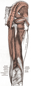Hamstring Strain
